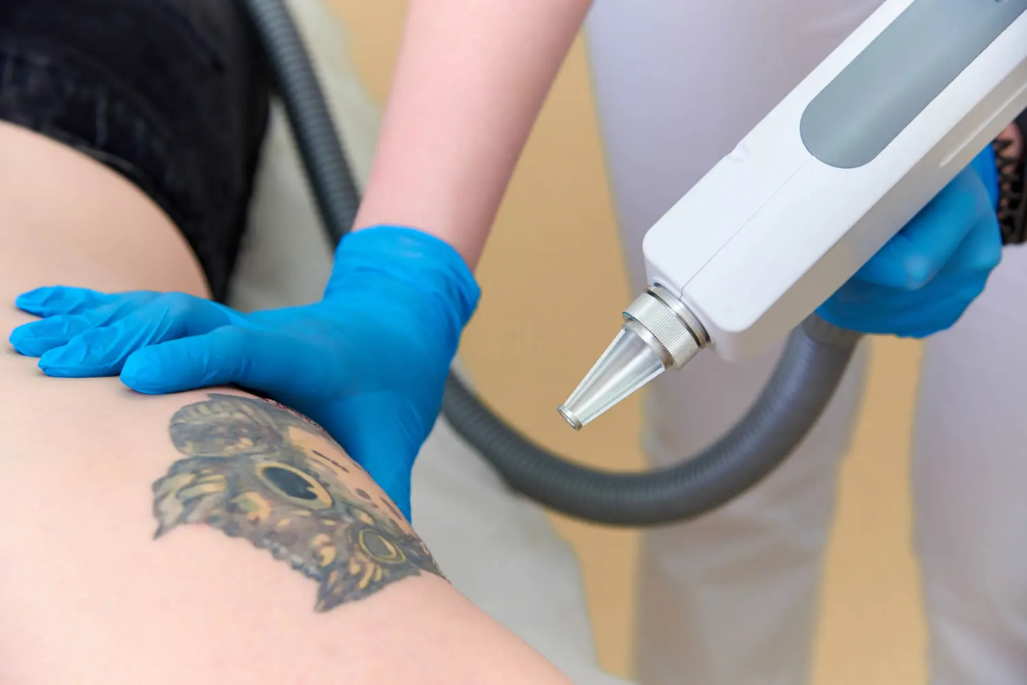 Bite-mark tattoos are having a moment. A dermatologist warns that they  could be dangerous. | Business Insider India